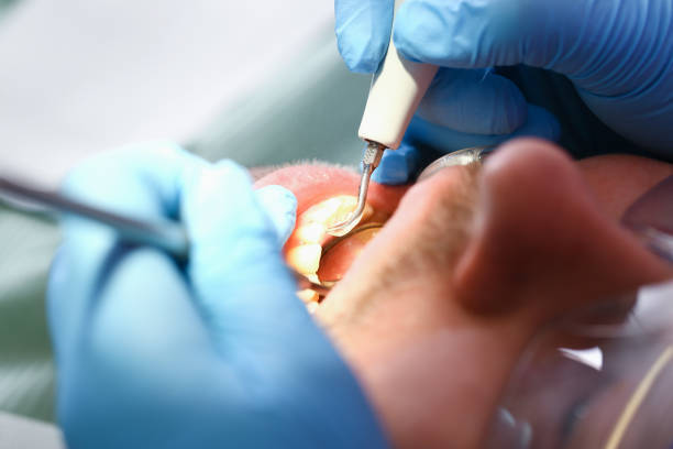 Best After-Hours Emergency Dentist in Stepping Stone, CO